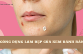 7 công dụng làm đẹp của kem đánh răng khiến bạn bất ngờ 